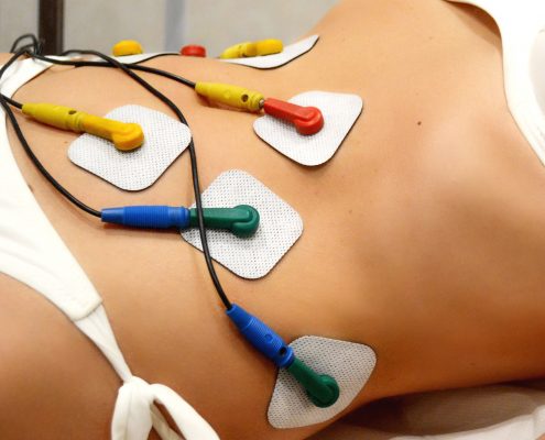 Elettroterapia | Riabilitazione Strumentale | NUBRA Medica