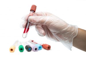 Esami del sangue | NUBRA Medica