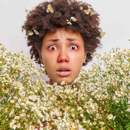 woman-surrounded-by-camomile-has-allergic-reaction-wildflowers-stares-has-red-swollen-eyes-poses-white