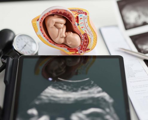 analisi prenatale | Nubra Medica | Carpi