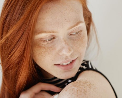 Con l'arrivo della bella stagione, è fondamentale proteggere la nostra pelle dai danni causati dai raggi solari. Leggi i consigli di Nubra Medica