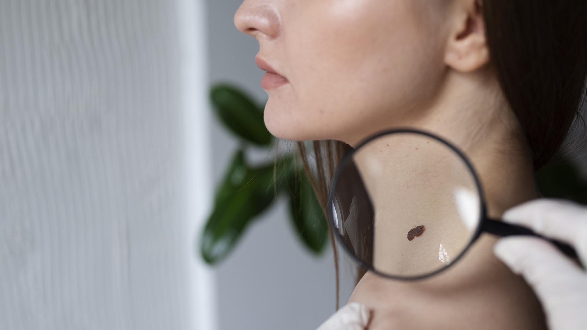 Prenota ora il tuo check-up della pelle. Un controllo può salvarti la vita. Un controllo dermatologico annuale può fare la differenza.